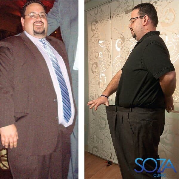 Soza Clinic patient before and after, photo 35