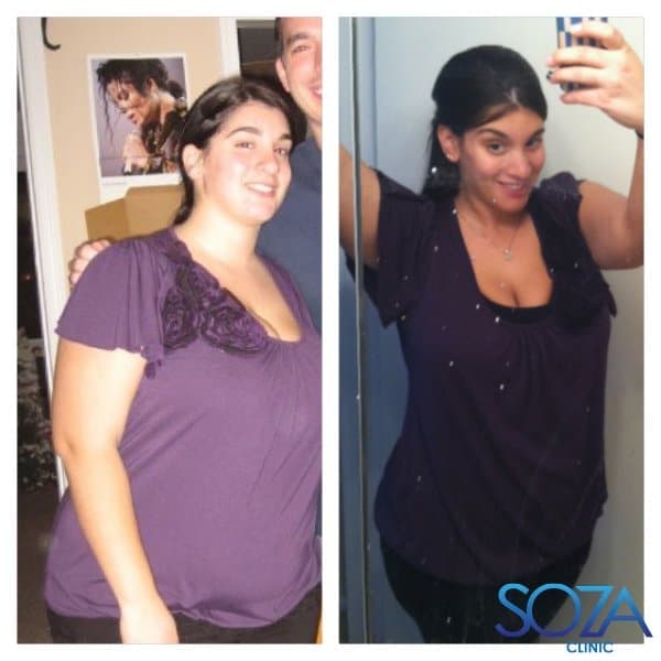 Soza Clinic patient before and after, photo 34