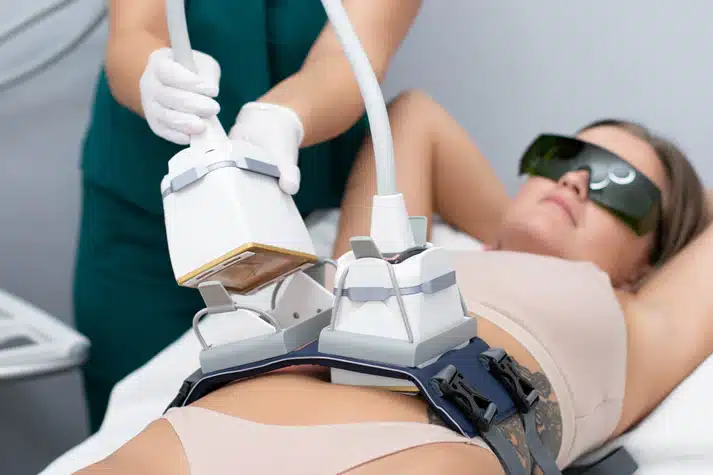 Venus Bliss diode laser applicators positioned on a patient's abdomen