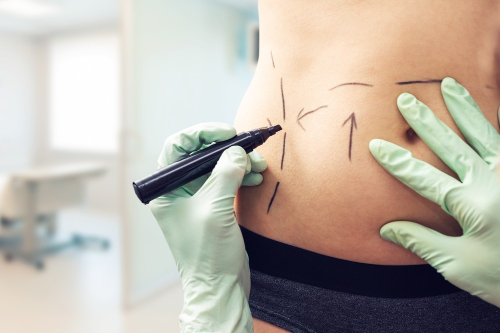 Body Contouring | Soza Clinic