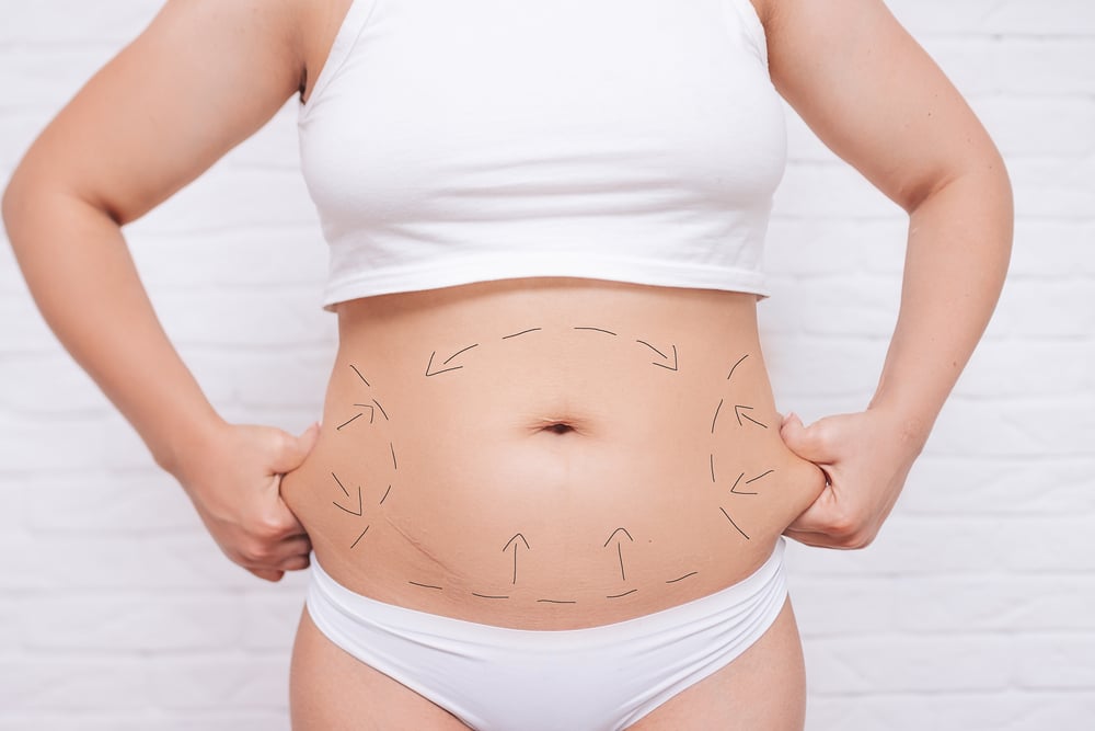 Body Contouring | Soza Clinic